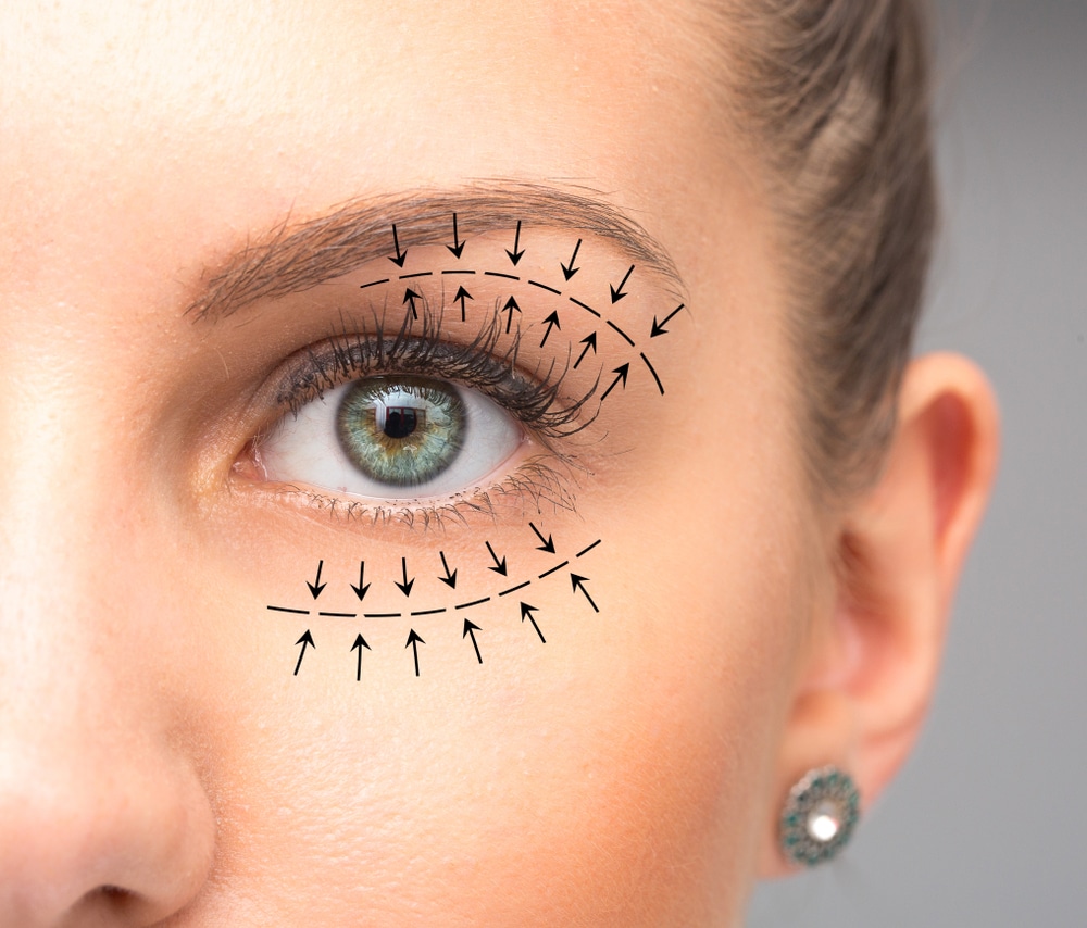 Exploring PRF Under Eyes: Benefits & Applications Demystified | San Diego Aesthetics & Med Spa